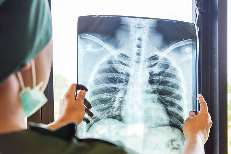 Accident Care Clinics of Texas | Services | Radiography | X-Rays
